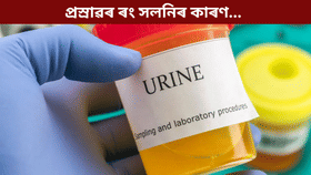 Urine: শীতকালত প্ৰস্ৰাৱৰ ৰং পৰিৱৰ্তন হোৱা কি ৰোগৰ লক্ষণ? জানক চিকিৎসকৰ পৰা…...