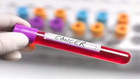 Cancer: হ্ৰাস পাব কেন্সাৰ হোৱাৰ সম্ভাৱনা! সলনি কৰক পুৱাৰ এই ৪টা অভ্যাস…...