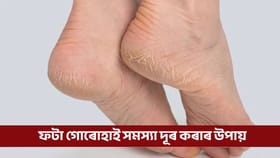ভৰিৰ ফটা গোৰোহাই সমস্য়াত পেলাইছে নেকি? এই যাদুকৰী টিপচে দূৰ কৰিব সমস্যা...
