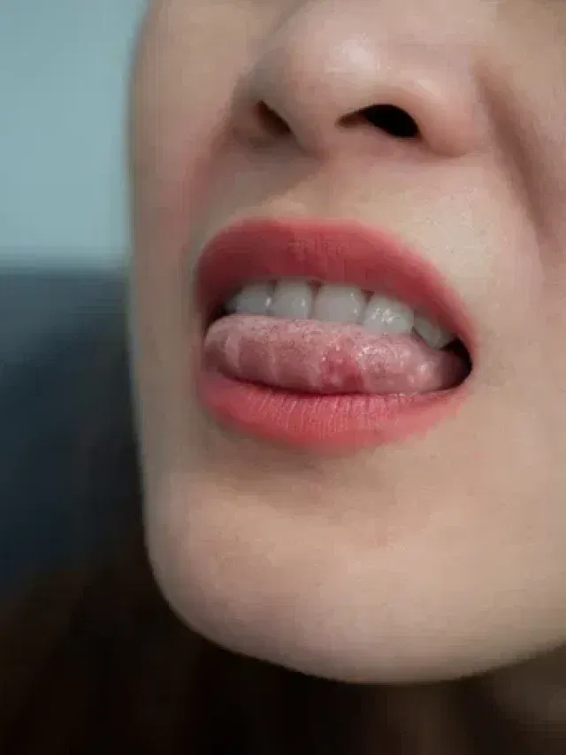 জিভাত কিয় বাৰে বাৰে ঘাঁ হয়? কাৰণ জানক…