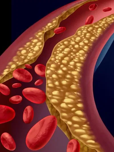 উচ্চ কলেষ্টেৰল নিয়ন্ত্ৰণত ৰাখিবলৈ খাওক এইবিধ ফল, আছে বহু উপকাৰিতা