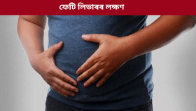Fatty Liver Symptoms: পৰীক্ষা নকৰাকৈ জানক! ফেটি লিভাৰ হ’লে দেখা দিয়ে এই ৫টা লক্ষণ, জনালে চিকিৎসক…...