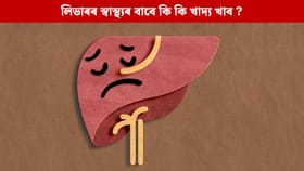 শীতকালত লিভাৰ সুৰক্ষিত কৰি ৰাখিবলৈ এই খাদ্যবোৰ খোৱাটো অতি প্ৰয়োজন…...