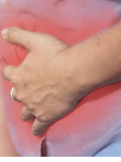 যকৃতৰ সমস্যা হ’লে প্ৰাৰম্ভিক অৱস্থাত দেখা দিয়ে এই ৫টা লক্ষণ, জানক…