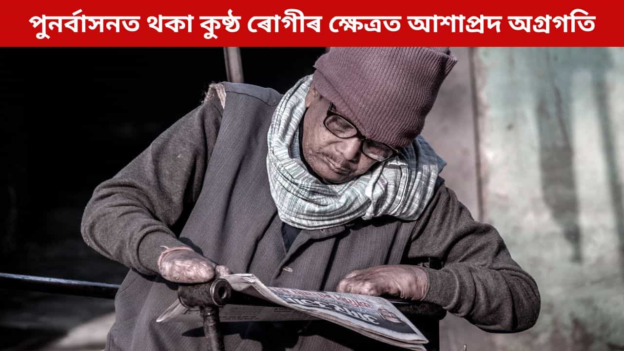পুনৰ্বাসনত থকা কুষ্ঠ ৰোগীৰ ক্ষেত্ৰত আশাপ্ৰদ অগ্ৰগতি, দেখুৱাইছে আশাৰ ৰেঙনি