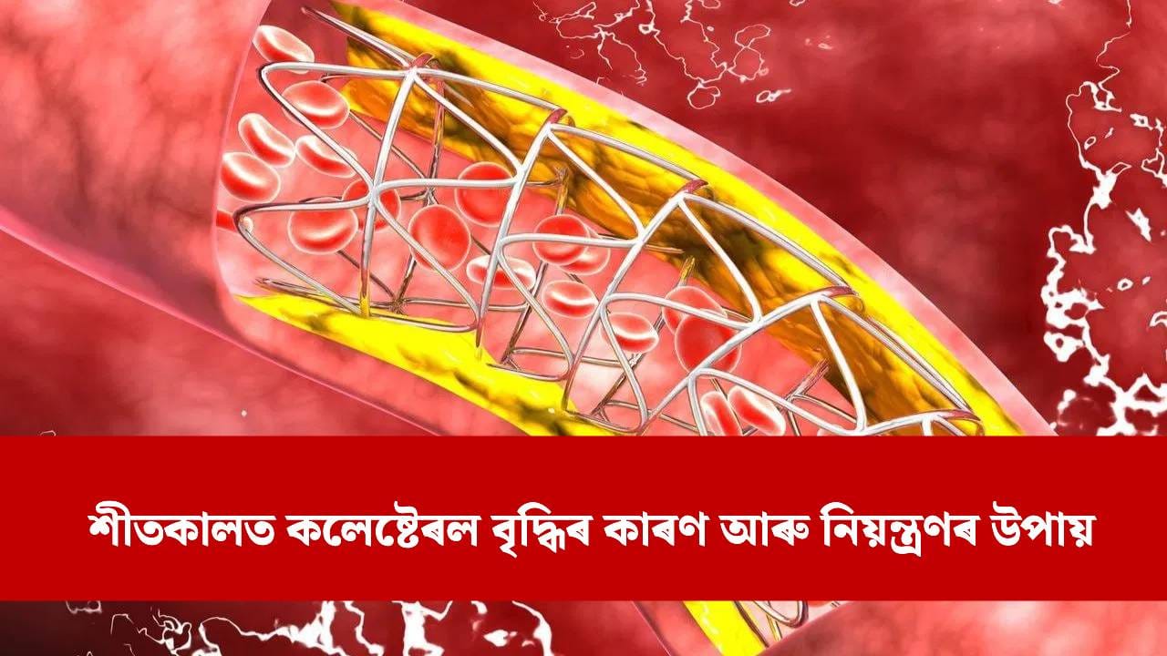 শীতকালত কলেষ্টেৰলৰ মাত্ৰা কিয় বৃদ্ধি পায় ? নিয়ন্ত্ৰণৰ বাবে এই খাদ্যবোৰ খাবলৈ আৰম্ভ কৰক