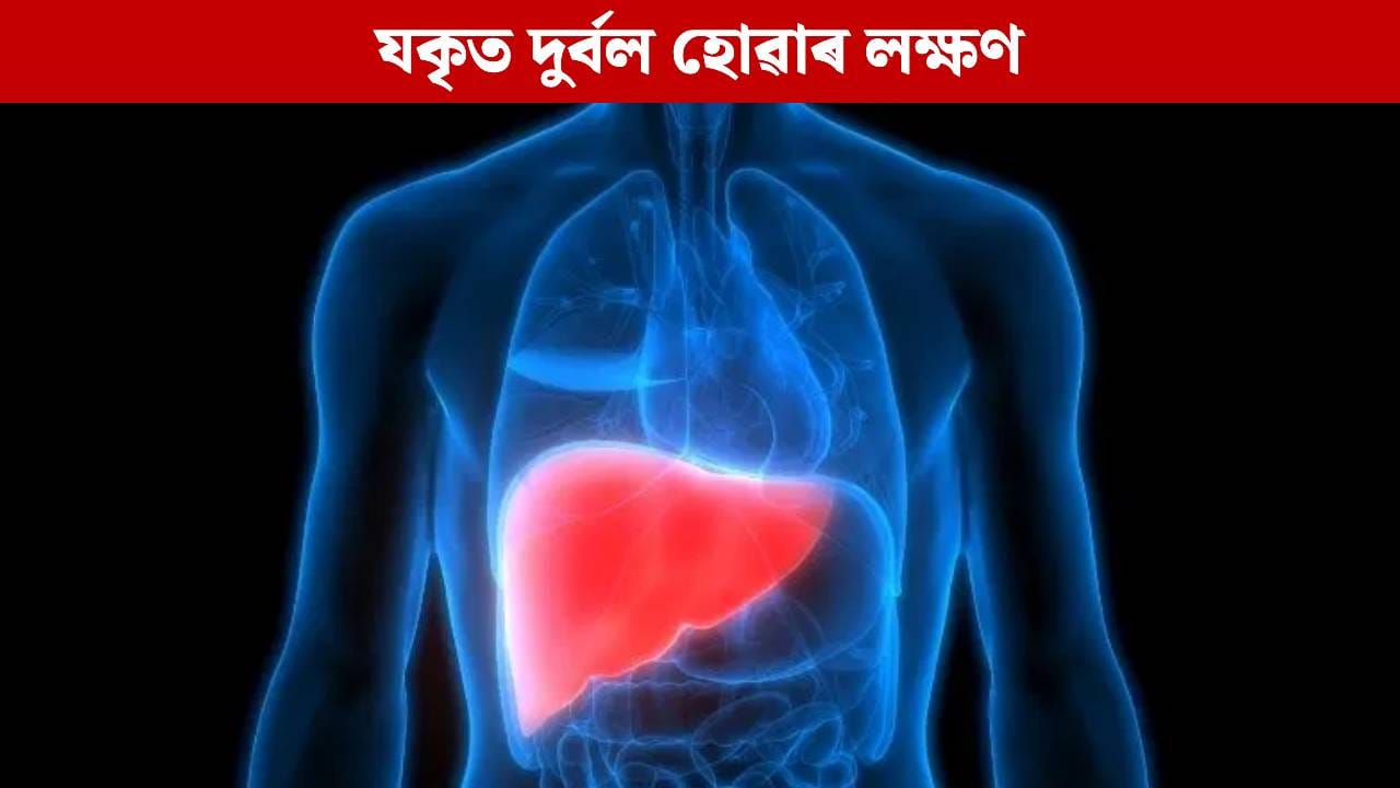 Liver: লিভাৰ দুৰ্বল হোৱাৰ আৰম্ভণিতে ছালত দেখা দিয়ে এইসমূহ লক্ষণ, জানক…