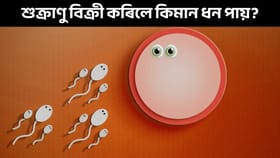 শুক্ৰাণু কোনে আৰু কেনেকৈ দান কৰিব? ইয়াৰ বাবদ কিমান টকা পায় জানো আহক...