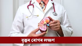 শৰীৰত দেখা এই চাৰিটা পৰিৱৰ্তনে দিয়ে বৃক্ক বিকল হোৱাৰ ইংগিত