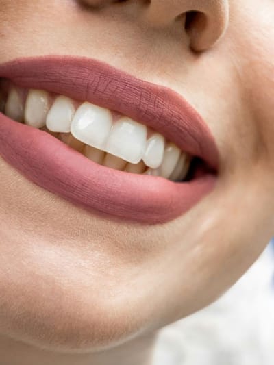 পাকঘৰৰ এই ২বিধ সামগ্ৰীৰে দূৰ কৰক দাঁতৰ সমস্যা