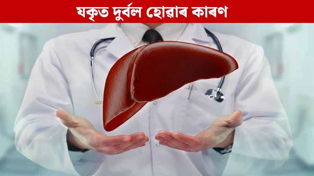 Liver: পুৱাৰ এই সাধাৰণ অভ্যাসে দুৰ্বল কৰিব পাৰে লিভাৰ, সাৱধান হওক... Liver: পুৱাৰ এই সাধাৰণ অভ্যাসে দুৰ্বল কৰিব পাৰে লিভাৰ, সাৱধান হওক...