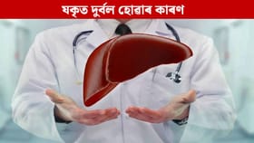 Liver: পুৱাৰ এই সাধাৰণ অভ্যাসে দুৰ্বল কৰিব পাৰে লিভাৰ, সাৱধান হওক…...