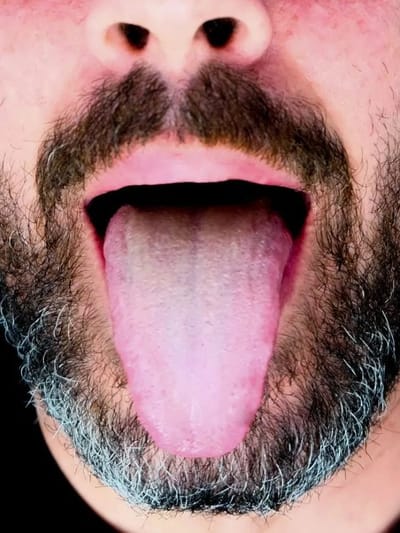 সঘনাই আপোনাৰ জিভা শুকাই যায় নেকি ? ই কিহৰ ইংগিত দিয়ে? জানক