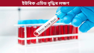 Uric Acid: শীতকালত বৃদ্ধি পাই ইউৰিক এচিডৰ সমস্যা! এই লক্ষণসমূহ ভুলতো নকৰিব আওকাণ, জানক সকলো…
