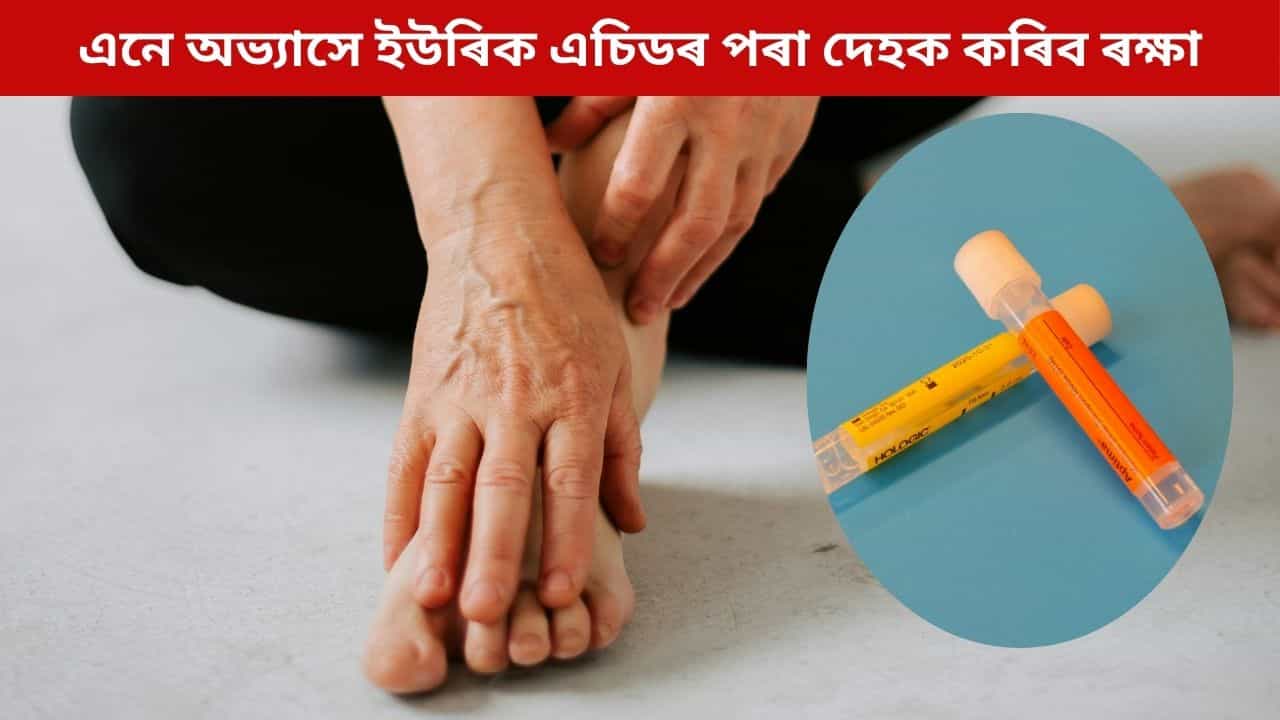 ইউৰিক এচিডৰ সমস্যাৰ পৰা ৰক্ষা পৰিব আপুনি, মাত্ৰ মানি চলক এনে অভ্যাস