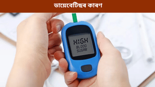 Diabetes: ডায়েবেটিছৰ মূল কাৰণ এই ৫টা অভ্যাস! জানক চিকিৎসকৰ পৰা…
