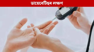 ব্লাড চুগাৰ বৃদ্ধি হ’লে নিশা এইবোৰ লক্ষণে দেখা দিয়ে, জানক…
