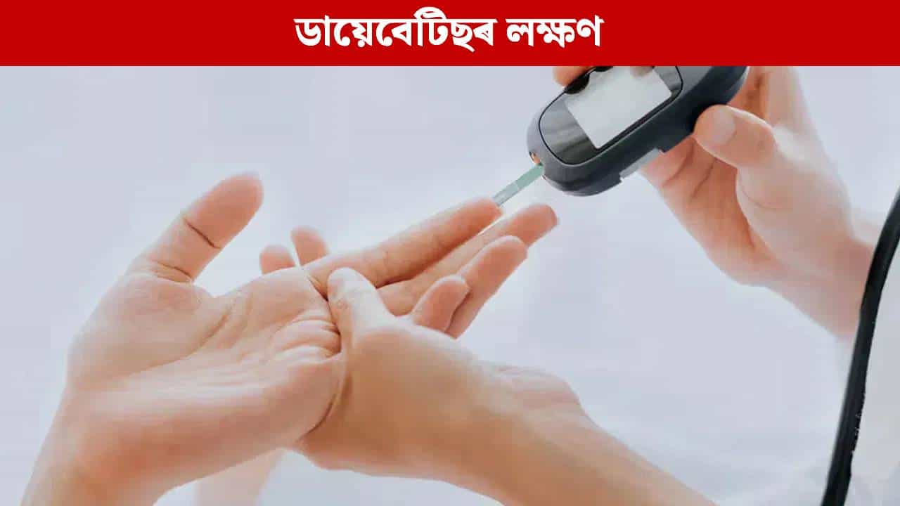 ব্লাড চুগাৰ বৃদ্ধি হলে নিশা এইবোৰ লক্ষণে দেখা দিয়ে, জানক...