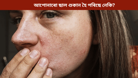 Dry Skin: শীতকালত ছাল শুকান হৈ পৰিলে কি কৰিব? জানক বিশেষজ্ঞৰ পৰা…...