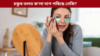 Eye Dark Circle: চকুৰ তলত ক’লা দাগ পৰা কি ৰোগৰ লক্ষণ? জানক চিকিৎসকৰ পৰা…