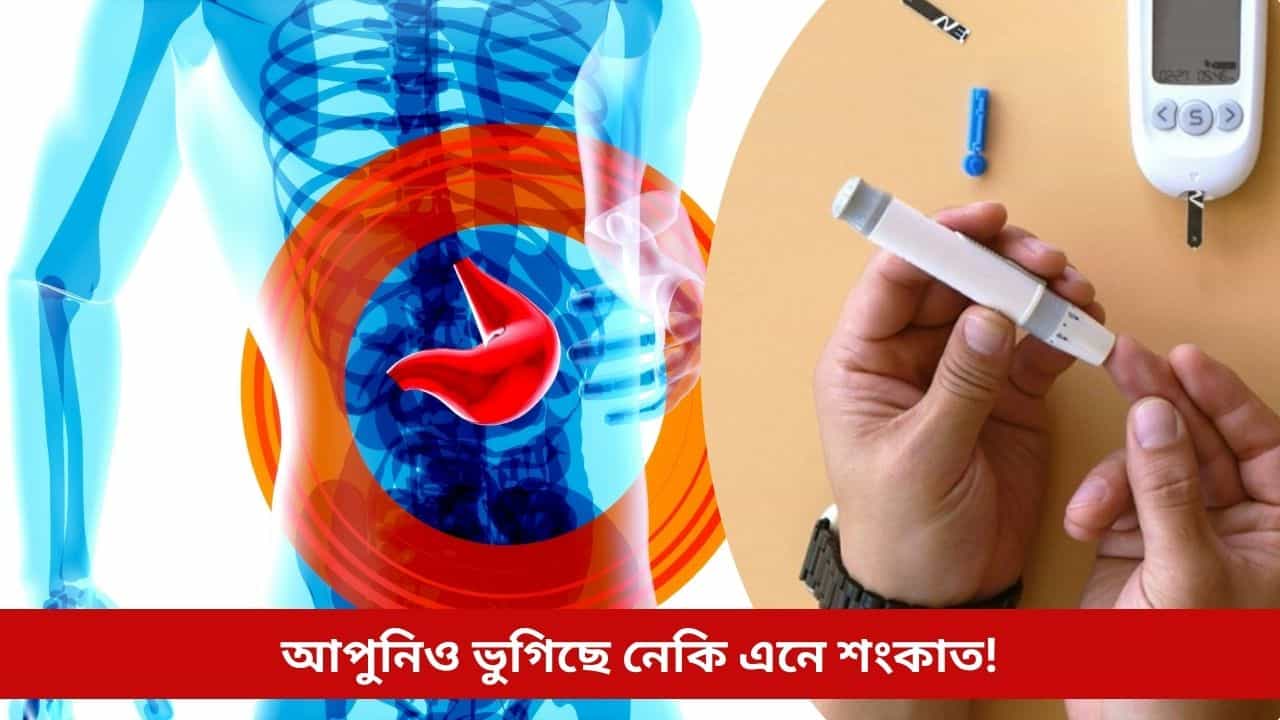 সাৱধান, ফেটি লিভাৰে বঢ়াব পাৰে ডায়েবেটিছৰ শংকা! বিপদত পৰাৰ পূৰ্বেই জানি লওক লক্ষণ তথা প্ৰতিকাৰৰ উপায়