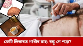 ফেটি লিভাৰ থকা লোকে গাখীৰ চাহ খালে কি হয়? জানক চাঞ্চল্যকৰ তথ্য..