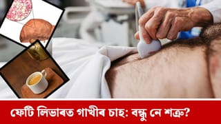 ফেটি লিভাৰ থকা লোকে গাখীৰ চাহ খালে কি হয়? জানক চাঞ্চল্যকৰ তথ্য…