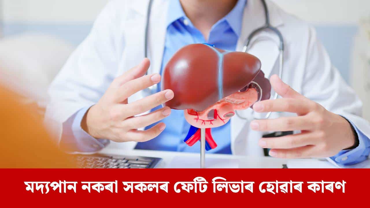 এই ৩টা অভ্যাসৰ বাবে ফেটি লিভাৰ ৰোগত আক্ৰান্ত লোকৰ সংখ্যা বৃদ্ধি পাইছে