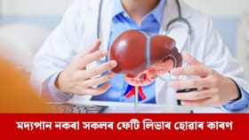 এই ৩টা অভ্যাসৰ বাবে ফেটি লিভাৰ ৰোগত আক্ৰান্ত লোকৰ সংখ্যা বৃদ্ধি পাইছে...