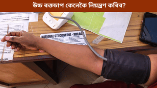 কম বয়সতে হৈছে নেকি উচ্চ ৰক্তচাপৰ সমস্যা? চিকিৎসকে জনালে নিয়ন্ত্ৰণৰ উপায়…