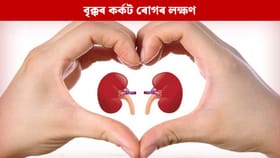 শৰীৰত দেখা এই ৮টা লক্ষণে দিয়ে কিডনী কেন্সাৰৰ ইংগিত, জানক...