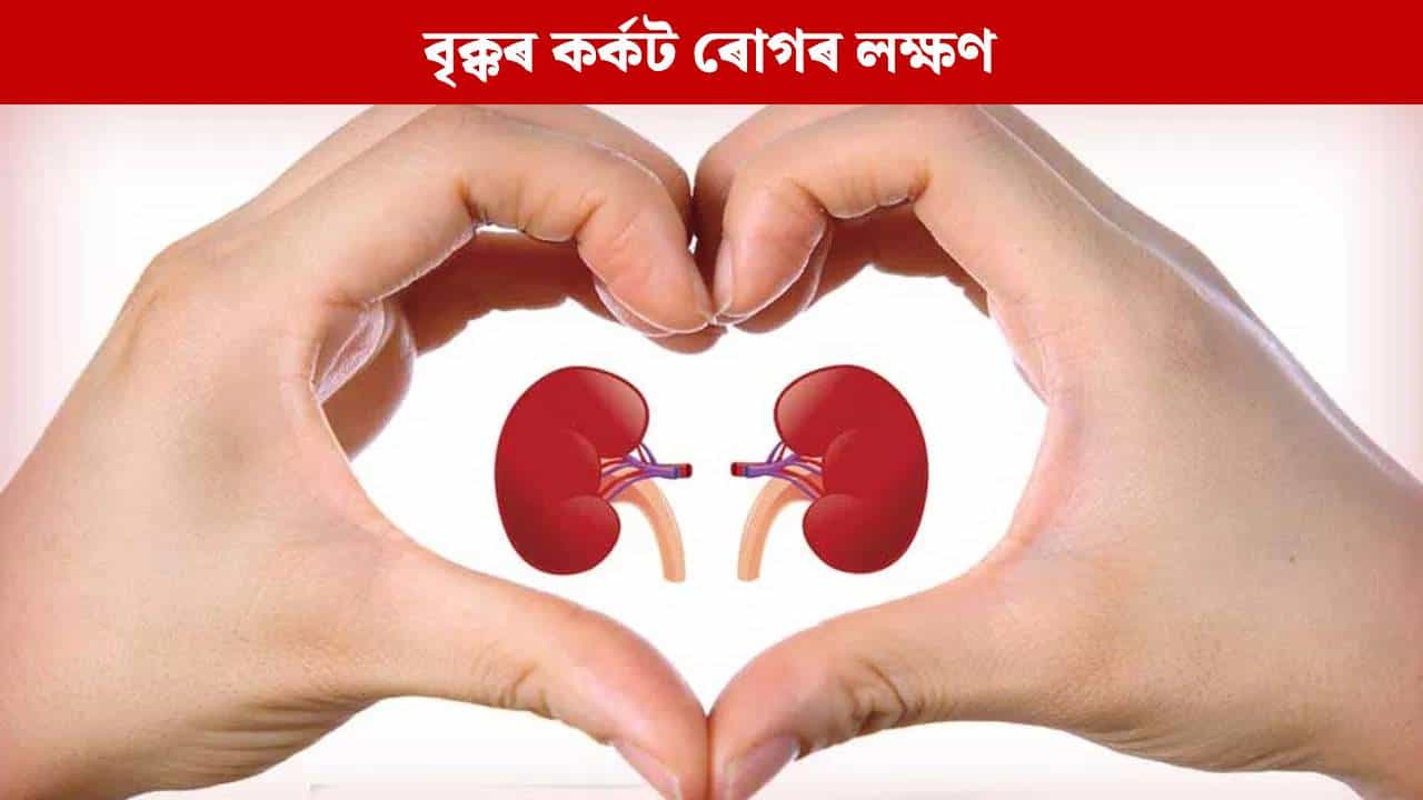 শৰীৰত দেখা এই ৮টা লক্ষণে দিয়ে বৃক্কৰ কৰ্কট ৰোগ হোৱাৰ ইংগিত, জানক...
