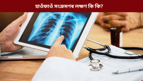 হাওঁফাওঁৰ সংক্ৰমণ হ'লে শৰীৰে কি কি ইংগিত দিয়ে, জনালে চিকিৎসকে...