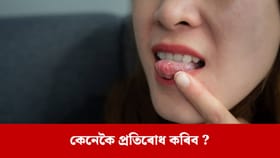 সঘনাই মুখৰ আলচাৰ হোৱাটো কিমান বিপজ্জনক?