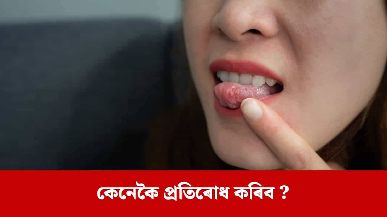 সঘনাই মুখৰ আলচাৰ হোৱাটো কিমান বিপজ্জনক? ই এটা সৰু সমস্যা নে কোনো গুৰুতৰ ৰোগৰ লক্ষণ?