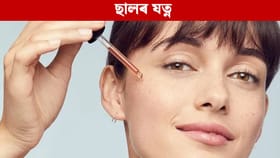 ছালৰ সমস্যাৰ বাবে অত্যন্ত উপকাৰী পতঞ্জলিৰ এই তেল