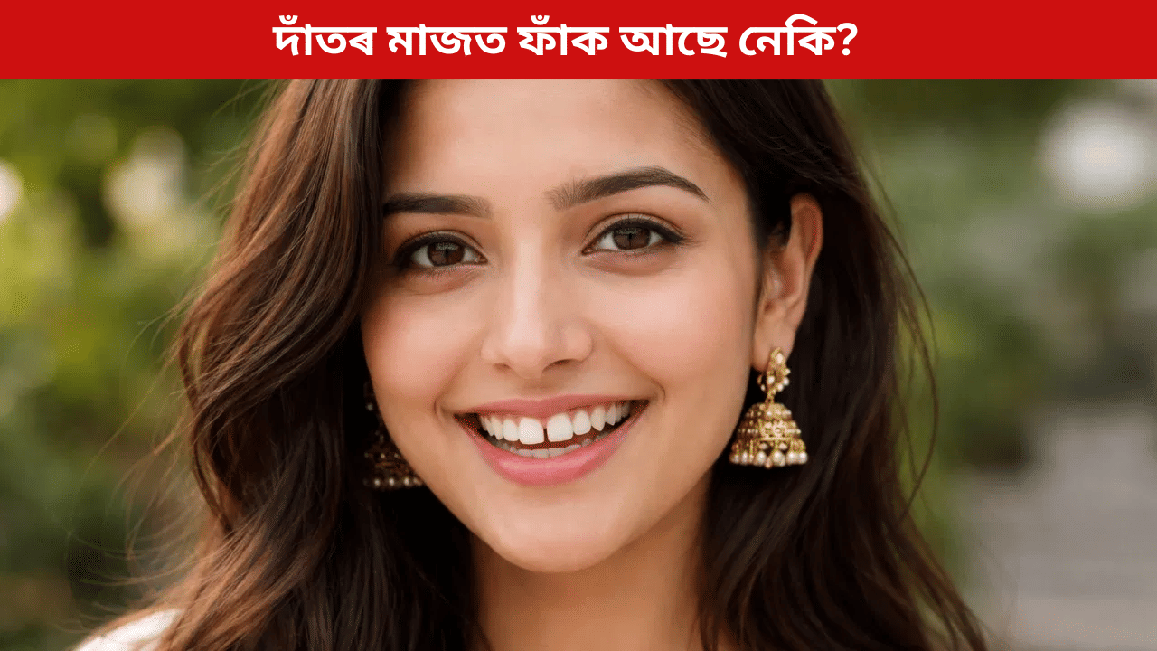 Teeth Gap Meaning: দাঁতৰ মাজত ফাঁক থকা শুভ নে অশুভ? জানক সামুদ্ৰিক শাস্ত্ৰৰ পৰা...