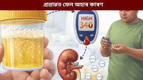 প্ৰস্ৰাৱত ফেন কিয় আহে? ই ডায়েবেটিছৰ লক্ষণ নেকি? জানক...