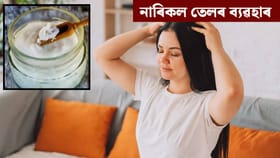 চুলি সৰা, উফিৰ সমস্যাৰ পৰা পাব সকাহ...লগাওক এই বস্তু
