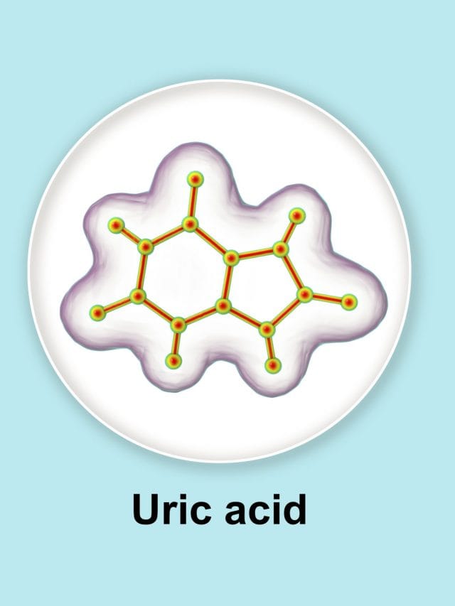 ইউৰিক এচিডৰ সমস্যা আছে নেকি ? এই ফলবোৰ কেতিয়াও নাখাব