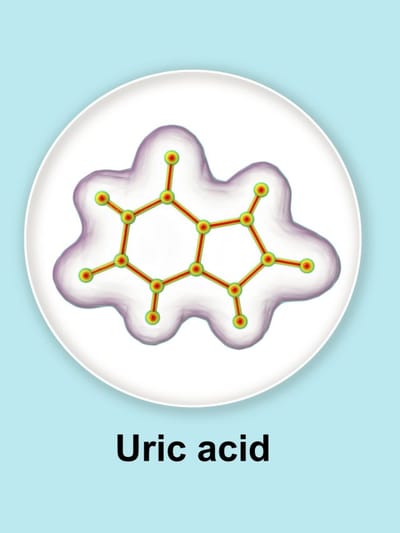 ইউৰিক এচিডৰ সমস্যা আছে নেকি ? এই ফলবোৰ কেতিয়াও নাখাব