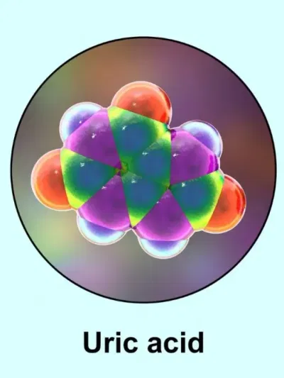 ইউৰিক এচিড বৃদ্ধি হ’লে শৰীৰে দিয়ে এইসমূহ ইংগিত? সবিশেষ জানক…
