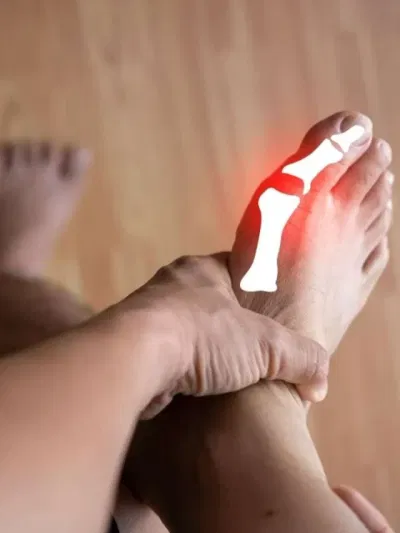 শৰীৰত ইউৰিক এচিড বৃদ্ধি পালে প্ৰথমে দেখা দিয়ে এইবোৰ লক্ষণে? জানক