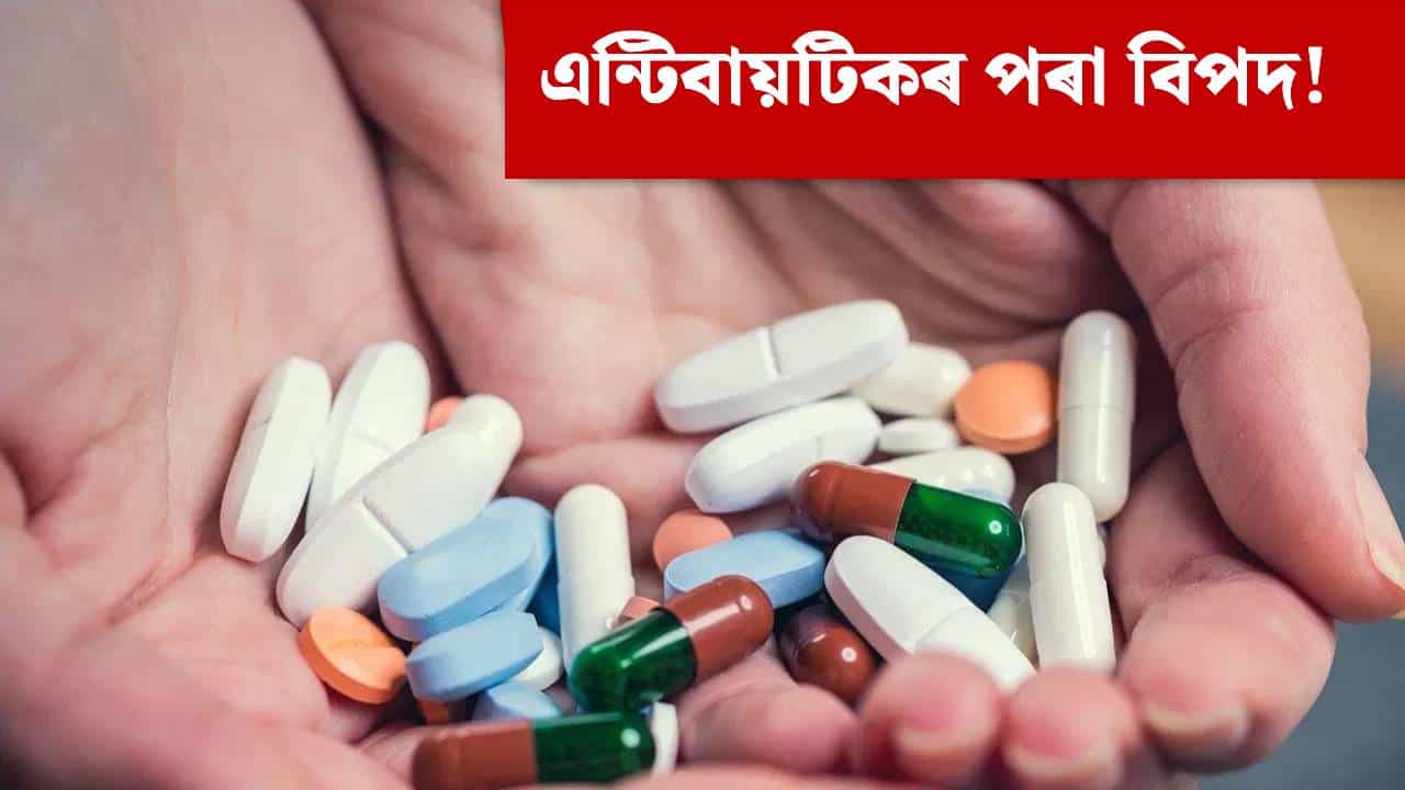 এন্টিবায়টিকে পেলাব পাৰে ডাঙৰ বিপদত! কেনেকৈ ব্যৱহাৰ কৰিব? সকলো জানক...
