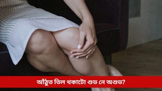 আপোনাৰ আঁঠুতো তিল আছে নেকি? পিছে এয়া শুভ নে অশুভ! শাস্ত্ৰই কৰিছে এনে বাখ্যা…