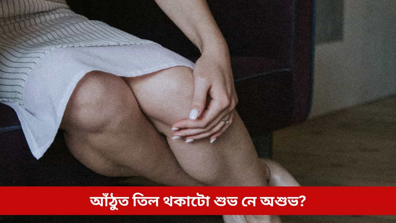 আপোনাৰ আঁঠুতো তিল আছে নেকি? পিছে এয়া শুভ নে অশুভ! শাস্ত্ৰই কৰিছে এনে বাখ্যা...