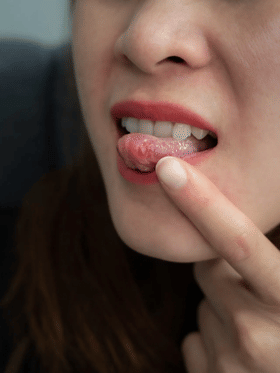 বাৰে বাৰে মুখৰ ঘাঁ কিয় হয়? জানক কাৰণ...