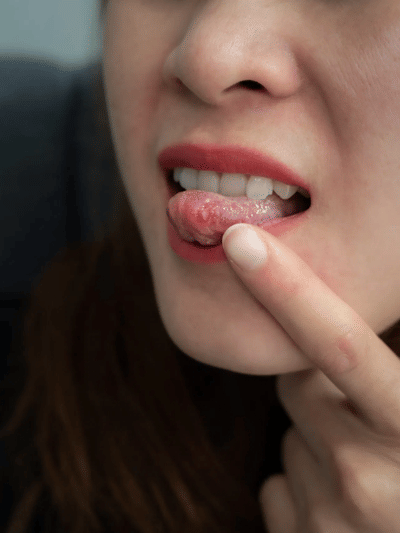 বাৰে বাৰে মুখৰ ঘাঁ কিয় হয়? জানক কাৰণ…