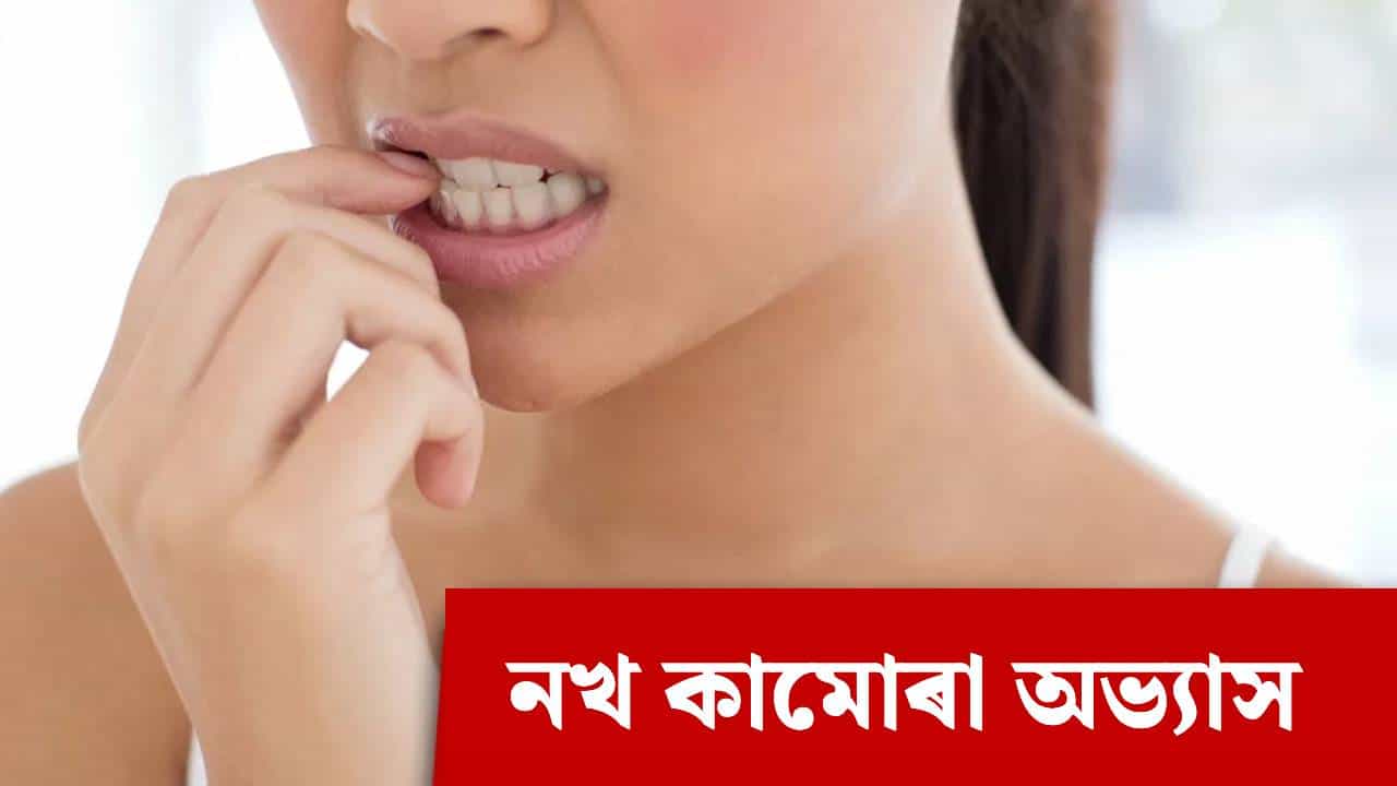 দাঁতেৰে নখ কামুৰিলে কি কি ৰোগ হব পাৰে? সাৱধান হওক দাঁতেৰে নখ কামুৰিলে কি কি ৰোগ হব পাৰে? সাৱধান হওক