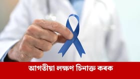 পুৰুষে সঘনাই প্ৰস্ৰাৱ কৰাটো কেন্সাৰৰ লক্ষণ হ’ব পাৰে নেকি ?